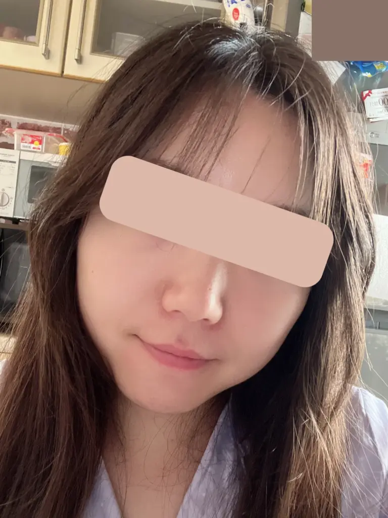 肌回復